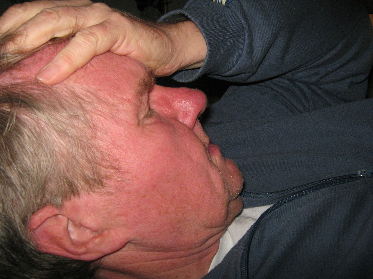 Naturalne sposoby na migrenę – akupunktura. Leczenie migren Białystok oraz Ślask